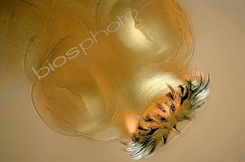 Biosphoto | 493102 | Détail du scolex du Taenia Cysticercus pisiformis ; La photographie est prise sous éclairage en lumière polarisée, avec un canon EOS 30D. Le grossissement est x100. La photographie est à 8.2 millions de pixels. | &copy; Christian Gautier / Biosphoto