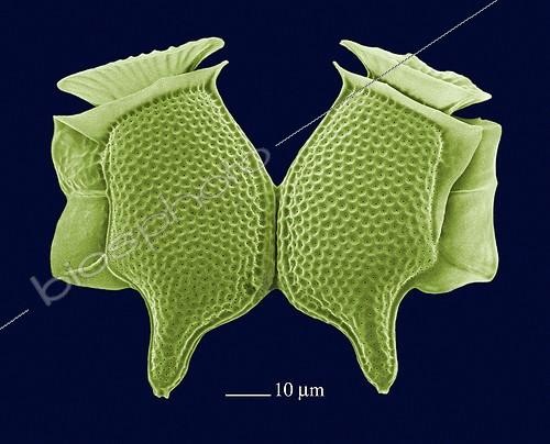Biosphoto | 512046 | Dinophysis caudata ; Microalgue. Liban. MICRO-ALGUES | &copy; Pascal Goetgheluck / Biosphoto