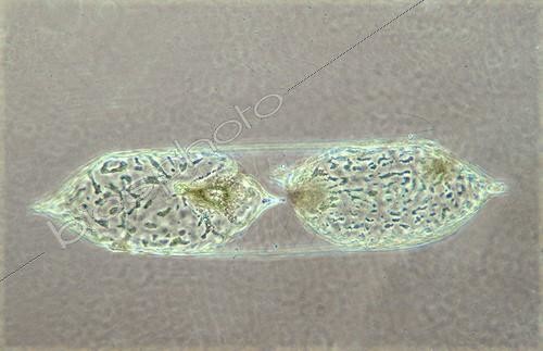 Biosphoto | 164564 | Division of Rhizosolenia diatoms in optical microscopy | &copy; Jean Lecomte / Biosphoto