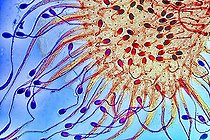 Biosphoto | 1621321 | Leaf of Drosera | &copy; Christian Gautier / Biosphoto