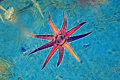 Biosphoto | 1781917 | Microscopic view of Deutzia Hair ; Polarized light illumination compensator Bereck, x 160 | &copy; Christian Gautier / Biosphoto