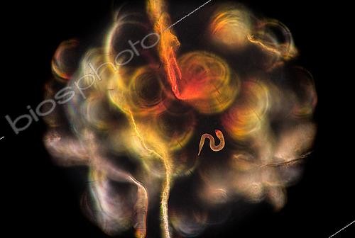 Biosphoto | 2620024 | Nematode (Epsilonema sp), Meiofauna of the abyss, Pourquoi pas les abysses ?, IFREMER, optical microscope. Nematodes are the most abundant group of animals in the abyss. They interest scientists in their ability to adapt to the most extreme conditions, such as the absence of oxygen or high temperatures.  | &copy; Gilles Martin / IFREMER / Biosphoto