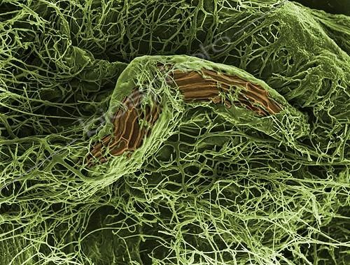 Biosphoto | 513647 | Orchid seed associated with a mushroom mycelium  ; The seed needs the fungus for germination.  | &copy; Pascal Goetgheluck / Biosphoto