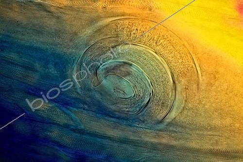Biosphoto | 1202328 | Pork muscle infested by larva of Trichinella encysted  ; Illumination with polarized light trim Bereck, x 400 | &copy; Christian Gautier / Biosphoto