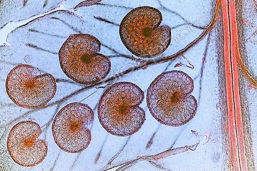 Biosphoto | 1781916 | Sporanges de Fougère mâle ; Éclairage en lumière polarisée, x 20 | &copy; Christian Gautier / Biosphoto