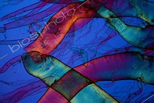 Biosphoto | 583930 | Trachées de Scolopendre sous microscope ; Eclairage en lumière polarisée avec lame compensatrice gypse, Grossissement x 50. | &copy; Christian Gautier / Biosphoto