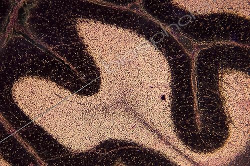Biosphoto | 495393 | Transversal cut of a human Cerebellum ; Lighting in black background, magnification x 50 | &copy; Christian Gautier / Biosphoto